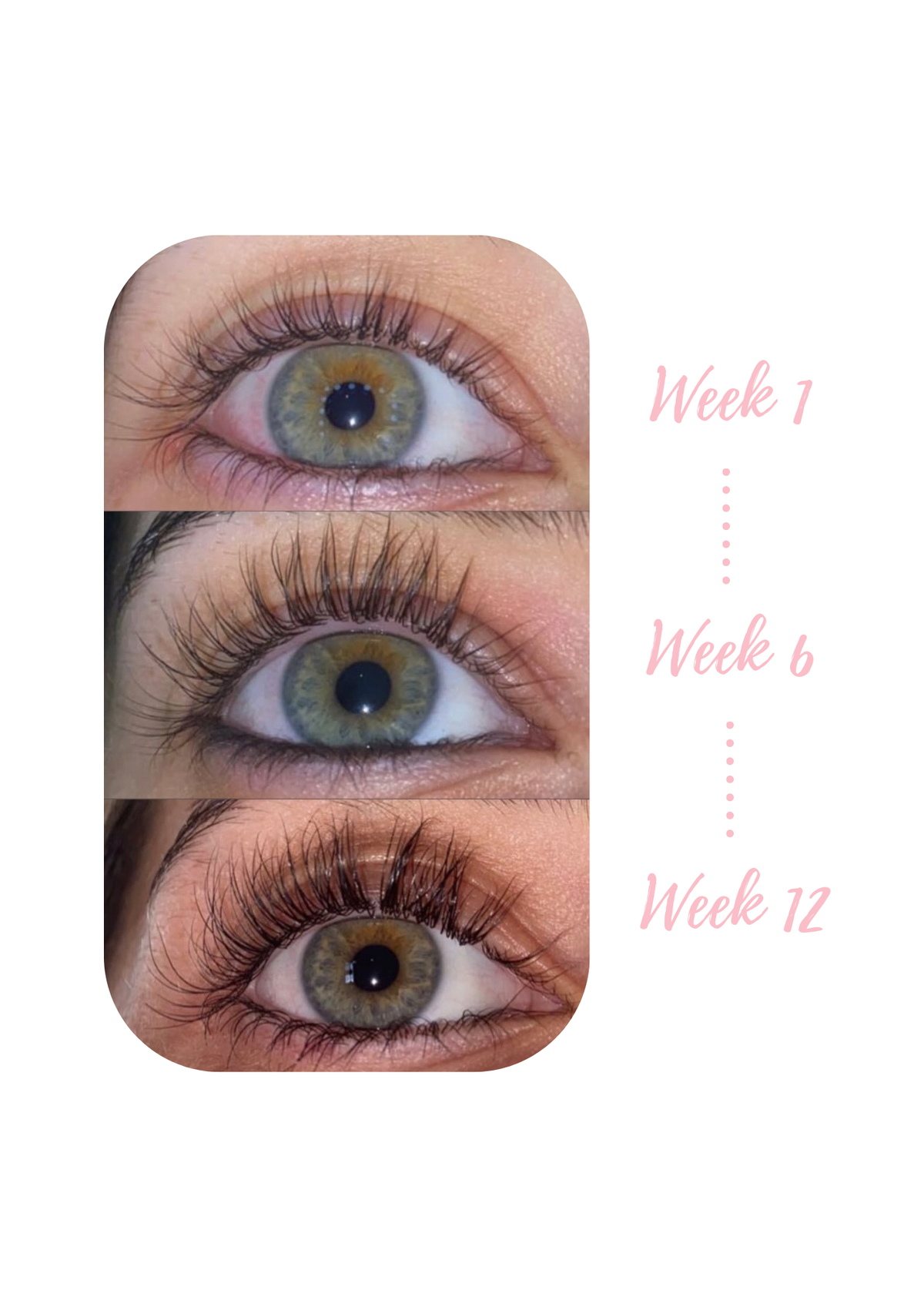 Lash Therapy Australia Growth Serum